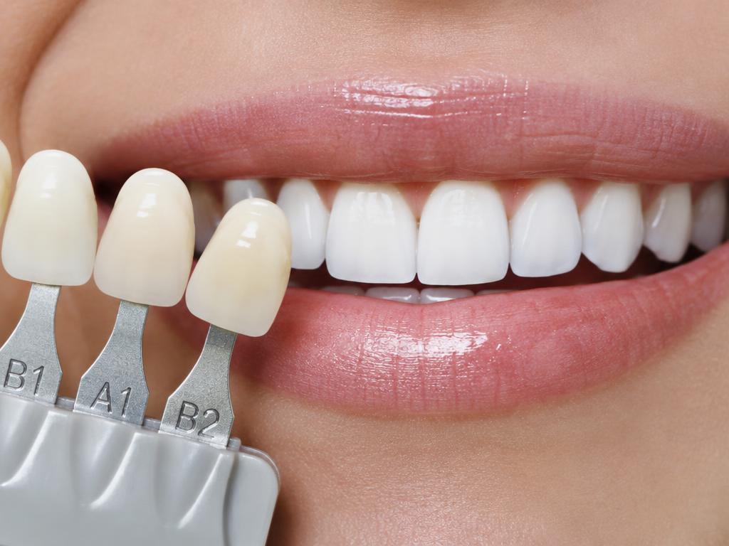 Blanqueamiento dental en Fumero Dental Center, Escazú