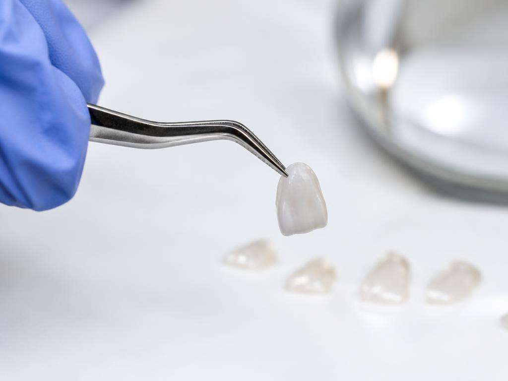 Carillas dentales en Fumero Dental Center, Escazú