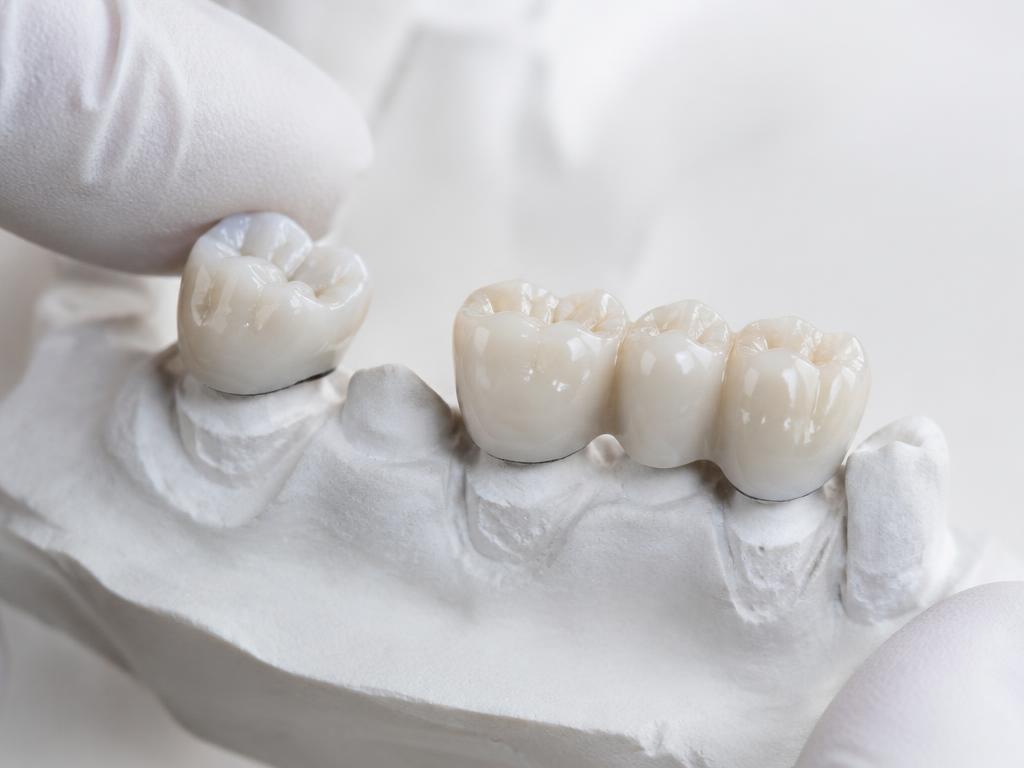 Prótesis dental en Fumero Dental Center, Escazú