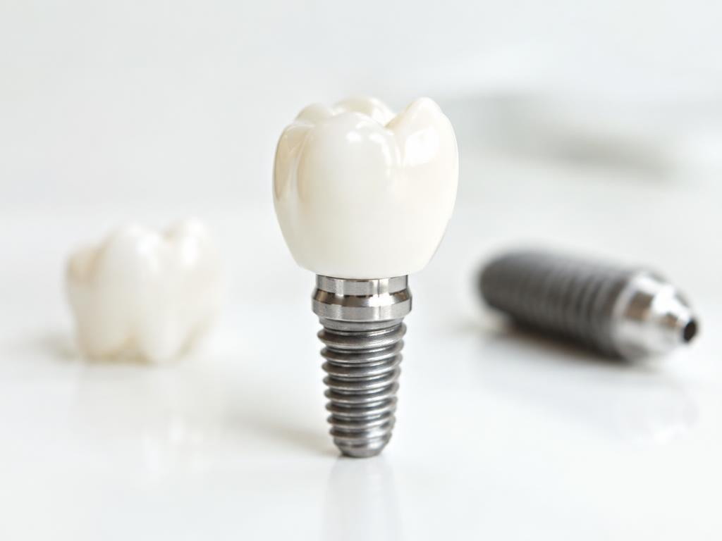 Implantes dentales en Fumero Dental Center, Escazú