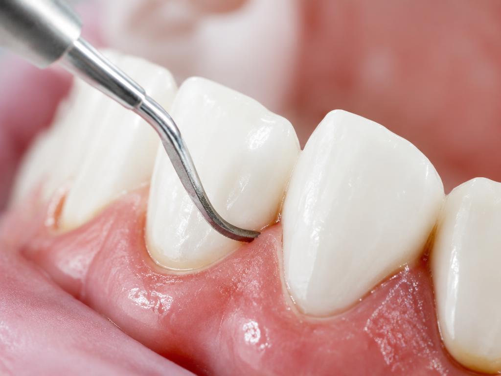 Limpieza dental en Fumero Dental Center, Escazú